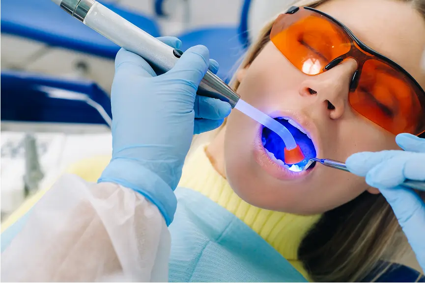 Dental Bonding in Grimsby